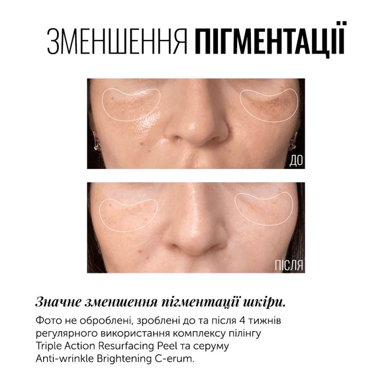 Instytutum WRINKLE BRIGHTENING C-ERUM