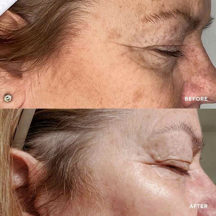 HydroPeptide Vital Eyes – Cироватка з миттєвою антивіковою дією